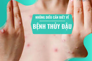 <a href="/quan-ly-nha-nuoc/truyen-thong-giao-duc-suc-khoe" title="Truyền thông giáo dục sức khỏe" rel="dofollow">Truyền thông giáo dục sức khỏe</a>